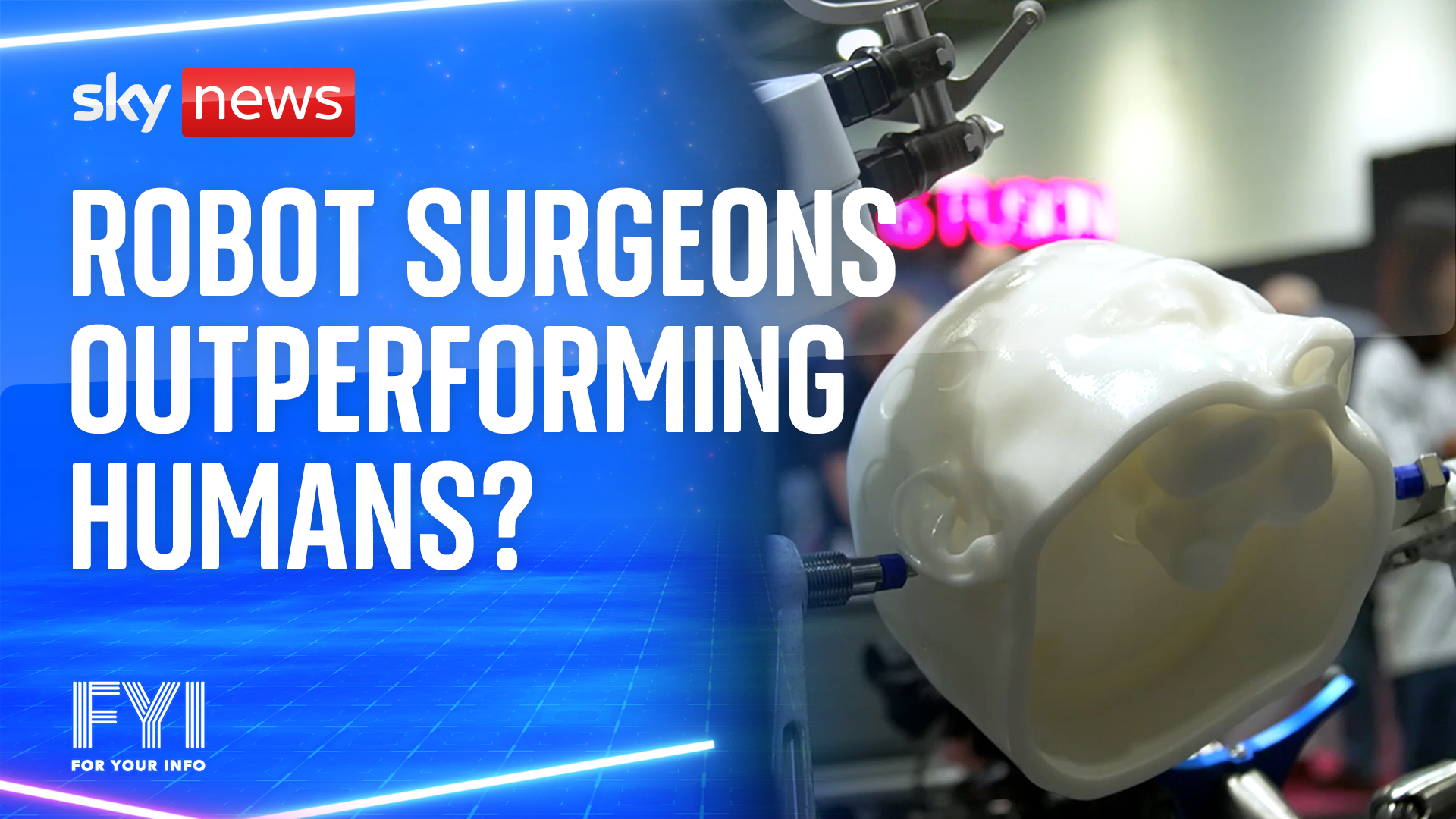 Robot surgeons outperforming humans?